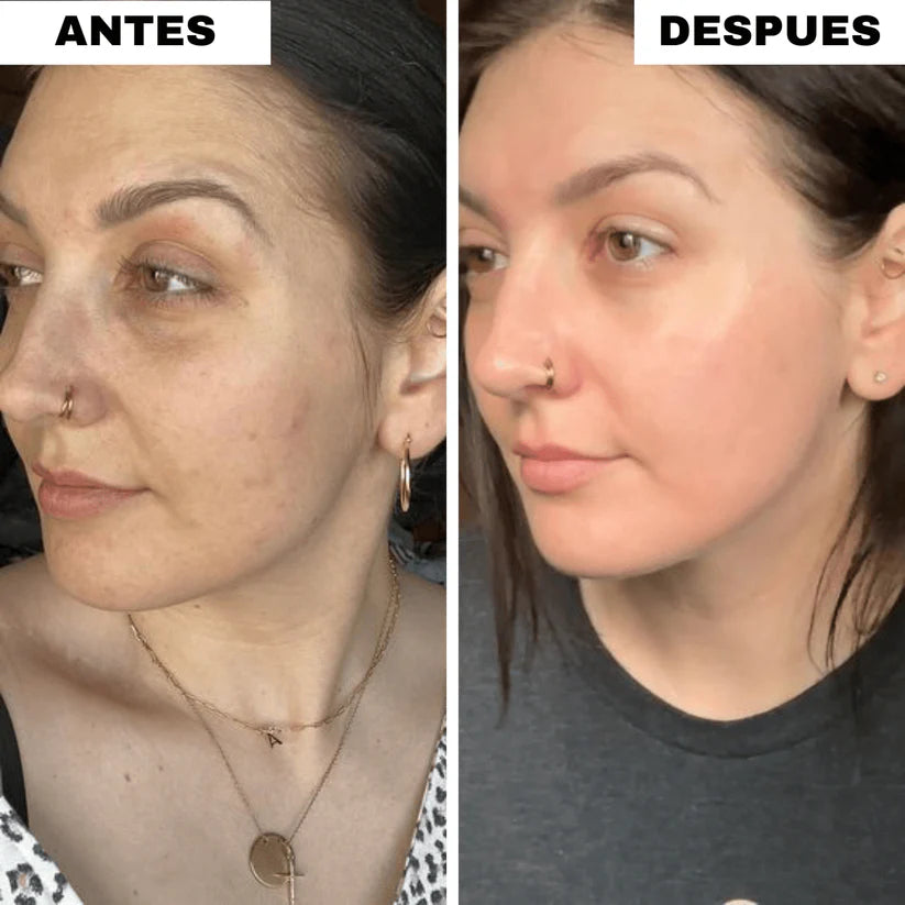 Pack Almohadillas Faciales Anti-Manchas OFERTA 2X1