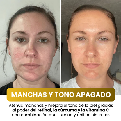 MASCARILLA FACIAL COREANA
