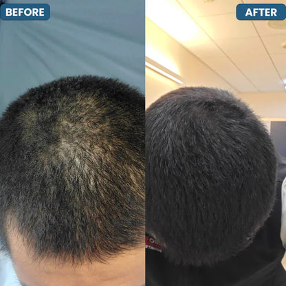 SERUM ROLL ON EDICION LIMITADA