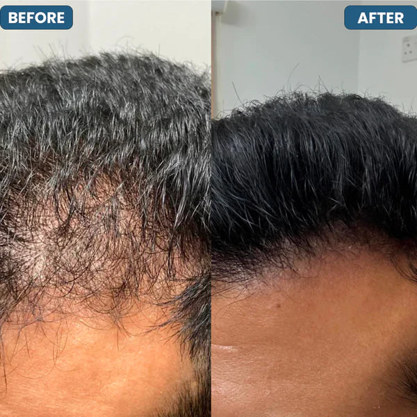 SERUM ROLL ON EDICION LIMITADA