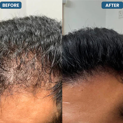 SERUM ROLL ON EDICION LIMITADA